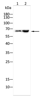 CAMKK2 Antibody