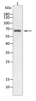 CAMKK2 Antibody