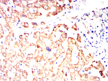 ACADM Antibody