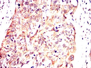 ACADM Antibody