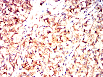 ACADM Antibody
