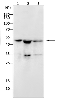 ACADM Antibody