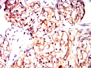 ITGB5 Antibody