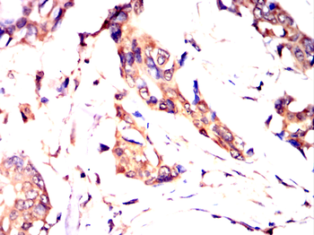 ITGB5 Antibody