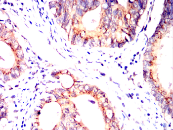 ITGB5 Antibody