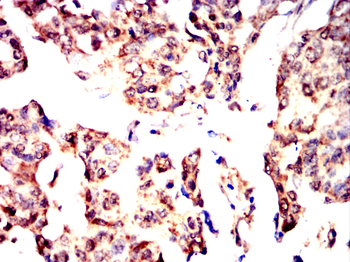 NDC80 Antibody