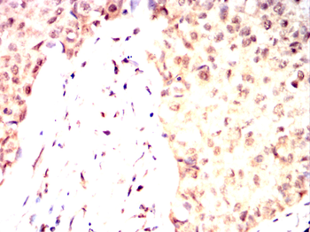 NDC80 Antibody