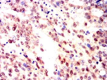 NDC80 Antibody