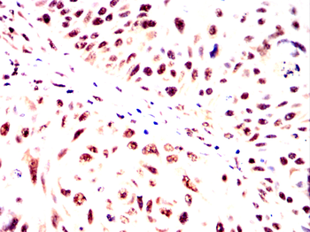 NDC80 Antibody
