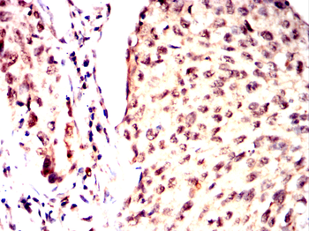 NDC80 Antibody