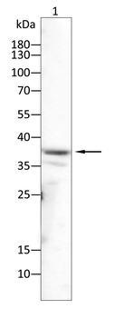 BDH1 Antibody