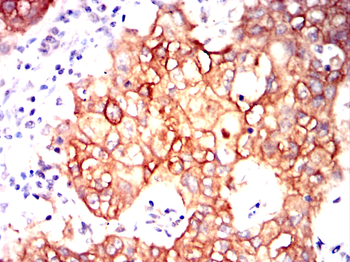RCHY1 Antibody