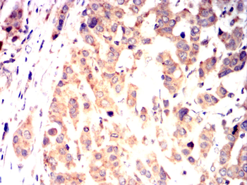RCHY1 Antibody