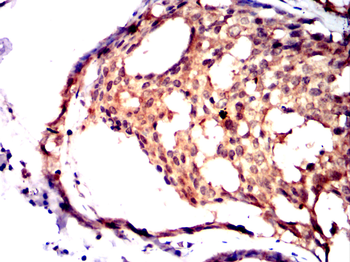 RCHY1 Antibody