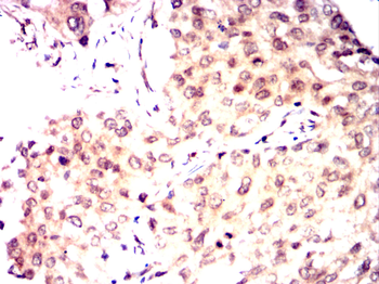 RCHY1 Antibody