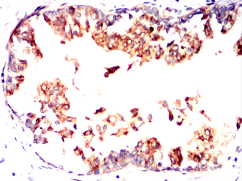 RCHY1 Antibody