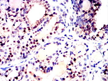 NKX3-1 Antibody
