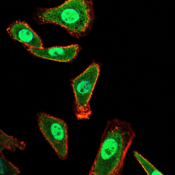 STAT5B Antibody