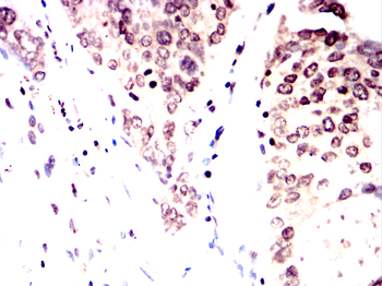 STAT5B Antibody
