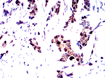 STAT5B Antibody