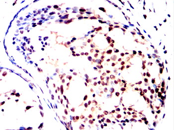 STAT5B Antibody
