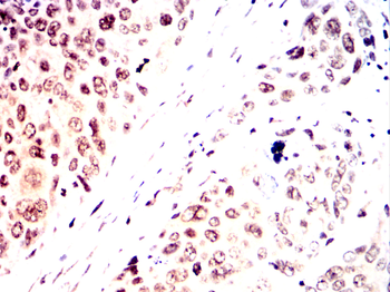STAT5B Antibody