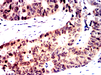 STAT5B Antibody