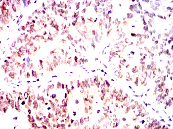 CRTC1 Antibody