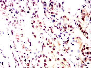 CRTC1 Antibody