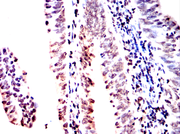 CRTC1 Antibody