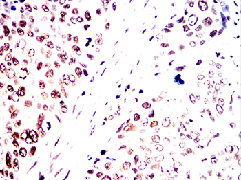 CRTC1 Antibody