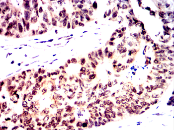 CRTC1 Antibody