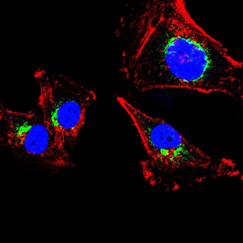 TRIB2 Antibody