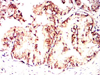 TRIB2 Antibody