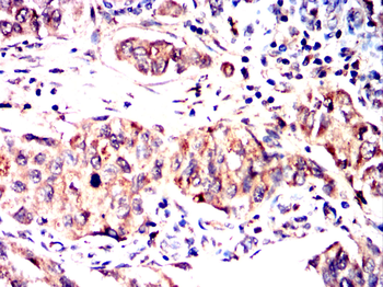 TRIB2 Antibody