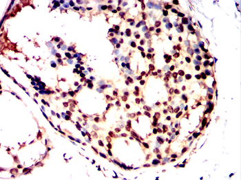 CDC25C Antibody