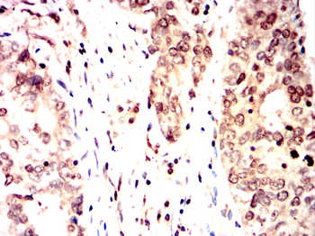 CDC25C Antibody