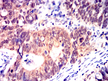 NFKBIB Antibody