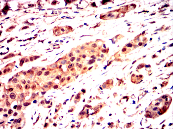 NFKBIB Antibody
