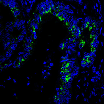 NFKBIB Antibody