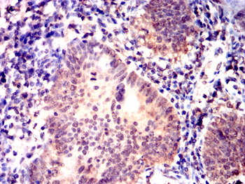 NFKBIB Antibody