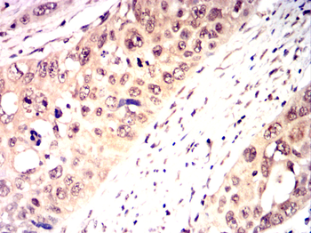 NFKBIB Antibody