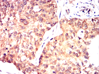 NFKBIB Antibody