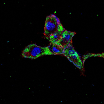 PTH1R Antibody