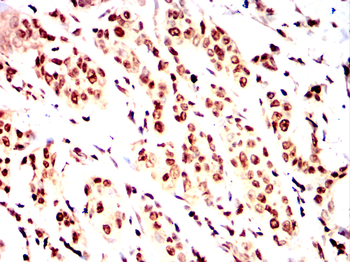 PTH1R Antibody
