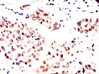 PTH1R Antibody