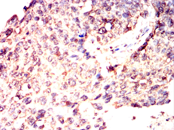 PTH1R Antibody