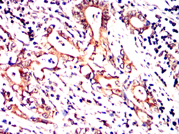 PTH1R Antibody