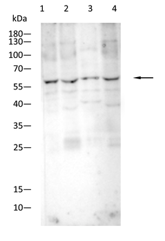 PTH1R Antibody