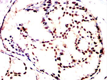 GFI1 Antibody